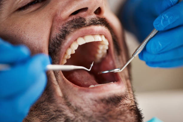 Best Emergency Denture Repair in Oak Island, NC